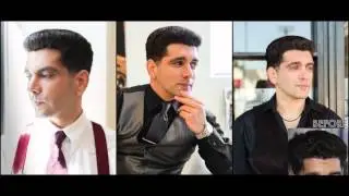 FUE Hair Transplant Results – Dr. Baubac Hayatdavoudi | Alvi Armani