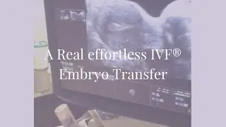 Watch a real effortless IVF&reg; embryo transfer