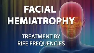 Facial Hemiatrophy (Parry Romberg Syndrome) - RIFE Frequencies Treatment - Quantum Medicine
