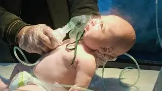 Gentle Nebulizer Therapy for a Cute Baby Girl with Bronchiolitis 🌸
