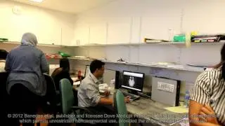 Poststroke stem cell therapy - Video abstract: 25745