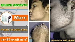 BEARD GROWTH ! Finally 1 months done ✔️ The Best Way to Grow a Beard for Beginners