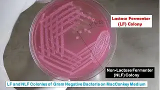 Lactose fermenter colony and Non-lactose fermenter Colony morphology of Gram-Negative Bacteria