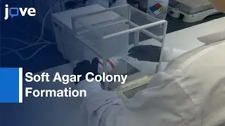 Soft Agar Colony Formation Assay to identify inhibitors of Tumors | Protocol Preview