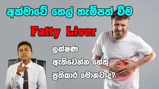 ඔබේ අක්මාවේ තෙල් තැම්පත් වෙලාද ?  අක්මාවේ තෙල් වලට බෙහෙත්  fatty liver treatment    Akmawe thel