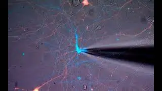 Investigating Therapies for Genetic Epilepsy with Alfred George, Jr., MD