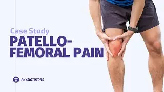 Patellofemoral Pain Case Study
