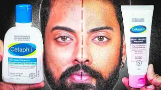 BEST Facewash for oily & sensitive skin | BEST CETAPHIL FACEWASH/CLEANSER IN INDIA | 30 DAY TEST