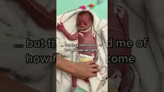 My Premature Miracle Baby was in a Fatal Car Accident ... #shorts