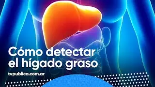 &iquest;Qu&eacute; es el h&iacute;gado graso? - En Casa Salud