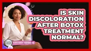 Is Skin Discoloration After Botox Treatment Normal?