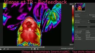 Accelerated thermal imaging video of face self massage_Raymond Lord