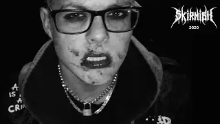 $kirmish - ASSHOLE (Official Music Video)