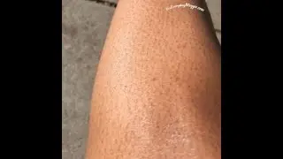My Exotic Resse's Beauty Secrets: Strawberry Legs and Smooth Skin