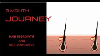 How To Make Your Hair Thicker ? | The Compete Guide | Sal Khan