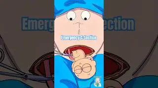 Экстренное кесарево сечение: когда естественные роды слишком рискованны!🚨 #кесарево сечение #аним...