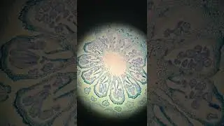 Toluidine Blue Stain