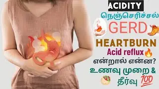 Acidity, Heartburn, Acid reflux, GERD அசிடிட்டி, ஹார்ட்பெர்ன், நெஞ்செரிச்சல் Causes, Gerd treatment 