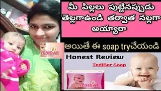 TEDI BAR soap honest review in telugu//teddibar soap for baby skin whitening