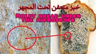 Moldy bread under the microscope|خبز متعفن تحت المجهر #microscope #tiktok #trending #food #nature