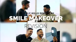 SMILE MAKEOVER REVISION | Beverly Hills Dentistry