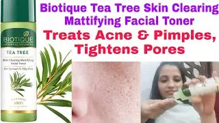 Biotique tea tree facial toner Honest Review || टोनर को मेने खुद लगाया है फिर रिव्यू कर रही हु ||