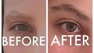 HOW I GREW FULL & THICK EYEBROWS FAST | REVITABROW
