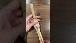 Дислокация радиуса