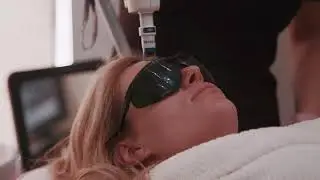 ClearLift or Hollywood Lift non invasive alternative to facial resurfacing or facelift treatment