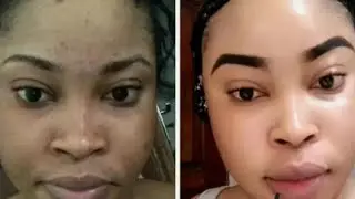Skin bleaching creams that works to penetrate stubborn skin fast and whitens the skin permanently.
