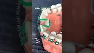 ОРТО ПОДГОТОВКА 🦷😬