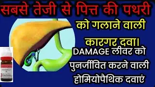 Best homoeopathic medicine For Damaged Liver/chionanthus virginica q by dr laxmiSharmadixit 