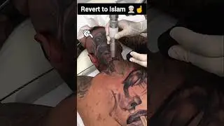 Man Removing Tattoo After Reverting to islam #shorts