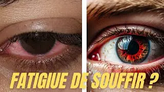 Yeux secs chroniques : pourquoi ça ne passe jamais ?