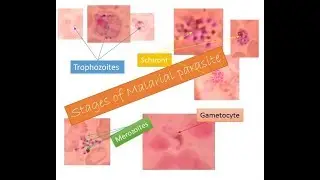 Malarial parasites identification within two minutes | Trophozoite| Schizont| Gametocyte| Merozoite