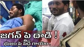 Ys jagan Attacked at Airport | ys jagan