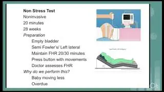 Non stress test #nursing #nursingstudent 