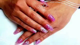 Acrylmodellage auf Tips