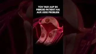 Uterus Fibroids Treatment Without Surgery |Hysterectomy | Gynecology | Dr. Gaurav Gangwani