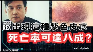 出現這種紫色皮疹就要特別小心了！死亡率高達80%