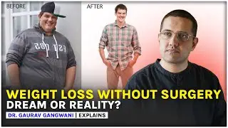 How to lose weight | Bariatric surgery | Weight loss surgery | Dr. Gaurav Gangwani