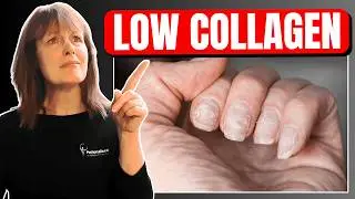 Don&rsquo;t Ignore These Shocking Signs of Low Collagen