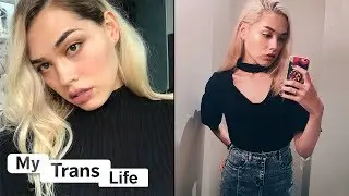 Surgery Has Given Me The Body I Always Wanted | MY TRANS LIFE