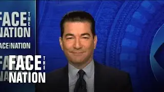 Gottlieb sees 