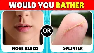 Would You Rather..! Hardest Choices Ever 😱😵‍💫😵/ 100 Impossible Choices