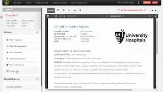 OpenContent Case - Bulk Redact Text