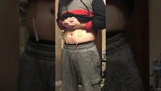 Stomach SHOCK