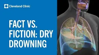 Dry Drowning: Fact vs. Fiction