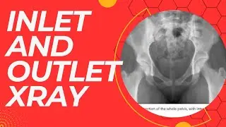 inlet and outlet of pelvis #inlet view #pelvis inlet view pelvis xray#positioning#pelvis xray