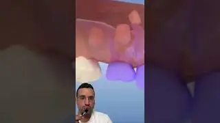Complications DENTS de LAIT 👇🏻